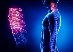 Reasons for the development of cervical osteochondrose